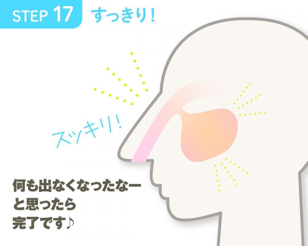 副鼻腔炎・蓄膿症の膿をスッキリ出して楽になりたい！自己流「吸引鼻うがい」